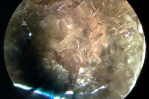 characteristic negative twinning three phase type inclusions with triangular shape