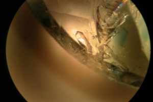 inclusione di tipo solido, sicuramente crescita interna di un piccolo cristallo di euclasio