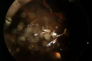 Gasblaseneinschlüsse in Libellen