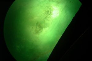 inclusions de type solide dans un jade impérial