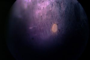 tube type liquid inclusions